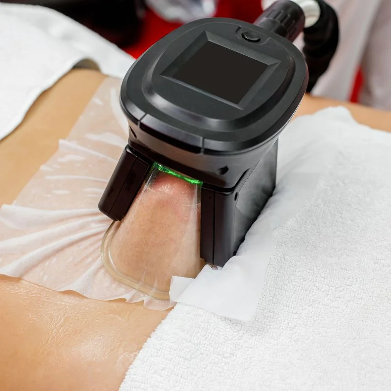 Fat Freezing treatment Earls Barton